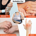 Cast Cover Hand 0825